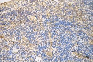 anti-Nuclear Factor-kB p65 (NFkBP65) antibody