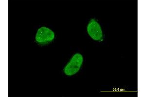 Immunofluorescence of monoclonal antibody to ZNF7 on HeLa cell. (ZNF7 抗体  (AA 67-165))