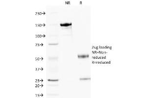 SDS-PAGE Analysis Purified Cytochrome C Mouse Monoclonal Antibody (6H2. (Cytochrome C 抗体)