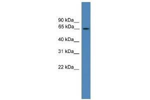 WB Suggested Anti-TBC1D19 Antibody Titration: 0. (TBC1D19 抗体  (Middle Region))