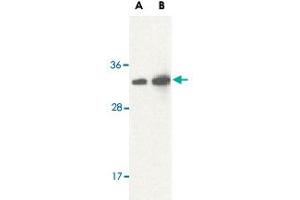 Western blot analysis of STRADB in human brain lysate with STRADB polyclonal antibody  at (A) 1 and (B) 2 ug/mL . (STRADB 抗体  (Internal Region))