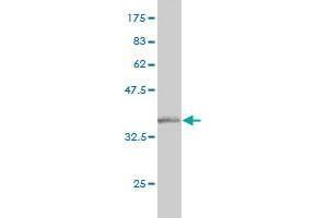 Western Blot detection against Immunogen (36. (NELL1 抗体  (AA 304-403))