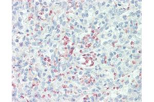 Anti-Mannose Receptor / CD206 antibody IHC staining of human spleen. (Mannose Receptor 抗体  (AA 359-388))