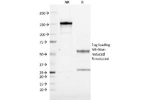 SDS-PAGE Analysis Purified ZFYVE28 Mouse Monoclonal Antibody (LST2/2426). (ZFYVE28 抗体)