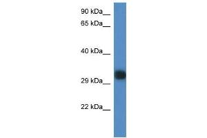 Mouse Spleen; WB Suggested Anti-Gm527 Antibody. (GM527 抗体  (C-Term))