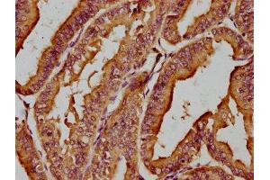 Immunohistochemistry (IHC) image for anti-Microtubule Associated Monoxygenase, Calponin and LIM Domain Containing 1 (MICAL1) (AA 806-1067) antibody (ABIN7141990)