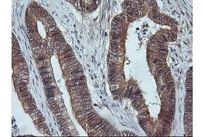 Image no. 2 for anti-Mitogen-Activated Protein Kinase Kinase 3 (MAP2K3) antibody (ABIN1499400) (MAP2K3 抗体)