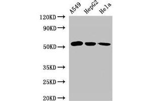 Western Blot Positive WB detected in: A549 whole cell lysate, HepG2 whole cell lysate, Hela whole cell lysate All lanes: ONECUT2 antibody at 2. (ONECUT2 抗体  (AA 214-331))