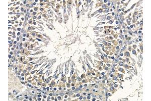 ABIN6258706 and ABIN6274819 at 1/100 staining rat testis tissue by IHC-P.