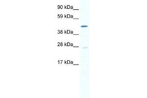 SMYD1 antibody used at 0. (SMYD1 抗体  (N-Term))