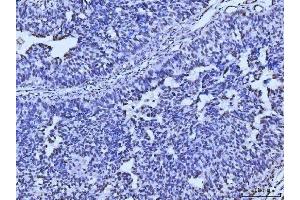 IHC analysis of MRE11 using anti-MRE11 antibody (ABIN7600025).