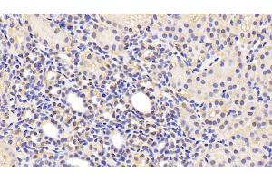 Immunohistochemistry (IHC) image for anti-zeta-Chain (TCR) Associated Protein Kinase 70kDa (ZAP70) (AA 337-600) antibody (ABIN7439081)
