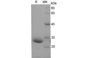 Western Blotting (WB) image for Prolactin (PRL) (Active) protein (His tag) (ABIN7320929) (Prolactin Protein (PRL) (His tag))