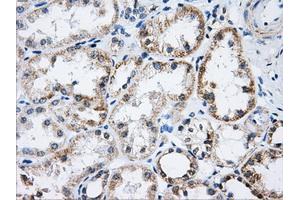 Immunohistochemistry (IHC) image for anti-Aconitase 2, Mitochondrial (ACO2) antibody (ABIN1496412) (ACO2 抗体)
