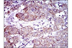 Immunohistochemistry (IHC) image for anti-Activated Leukocyte Cell Adhesion Molecule (ALCAM) (AA 48-216) antibody (ABIN1846222) (CD166 抗体  (AA 48-216))