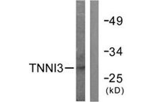 Western blot analysis of extracts from mouse heart cells, using TNNI3 (Ab-142) Antibody. (TNNI3 抗体  (AA 111-160))