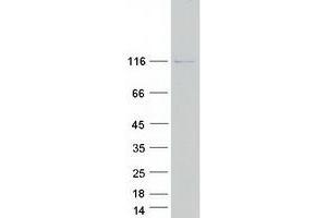 Western Blotting (WB) image for Inturned Planar Cell Polarity Effector Homolog (INTU) protein (Myc-DYKDDDDK Tag) (ABIN2723767)