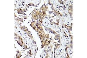 Immunohistochemistry (IHC) image for anti-AXL Receptor tyrosine Kinase (AXL) antibody (ABIN7265804)