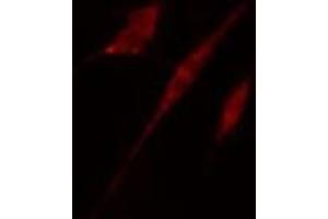 ABIN6278650 staining HT29 cells by IF/ICC. (CSNK1A1 抗体  (pTyr294))