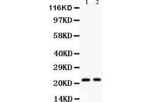Western Blotting (WB) image for anti-Interleukin 18 (IL18) (AA 37-193) antibody (ABIN3044311) (IL-18 抗体  (AA 37-193))