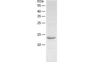 Hephaestin Protein (HEPH) (AA 968-1124) (His tag)