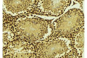 ABIN6268876 at 1/100 staining Mouse testis tissue by IHC-P. (PIAS4 抗体  (C-Term))