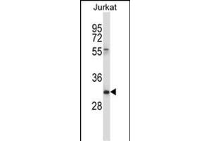 CD7 Antibody (Center) (ABIN657637 and ABIN2846633) western blot analysis in Jurkat cell line lysates (35 μg/lane). (CD7 抗体  (AA 63-92))