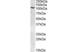Western Blotting (WB) image for anti-Transient Receptor Potential Cation Channel, Subfamily C, Member 6 (TRPC6) (AA 918-931) antibody (ABIN490466) (TRPC6 抗体  (AA 918-931))