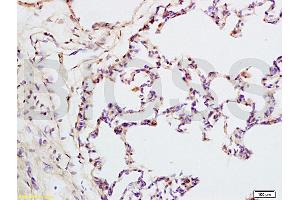 Formalin-fixed and rat lung tissue labeled with Anti-IQGAP1 Polyclonal Antibody, Unconjugated (ABIN737796) at 1:200 followed by conjugation to the secondary antibody and DAB staining (IQGAP1 抗体  (AA 1451-1550))