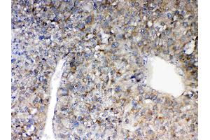 IHC analysis of MAVS using anti-MAVS antibody . (MAVS 抗体  (AA 34-96))