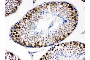Immunohistochemistry (IHC) image for anti-Cyclin-Dependent Kinase 1 (CDK1) (AA 66-297) antibody (ABIN3043473)