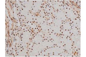 Immunohistochemistry (IHC) image for anti-Activating Transcription Factor 2 (ATF2) (pThr51), (pThr69) antibody (ABIN6256594)