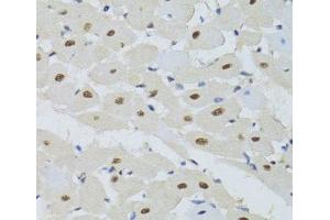 Immunohistochemistry of paraffin-embedded Mouse heart using DDB1 Polyclonal Antibody at dilution of 1:100 (40x lens).