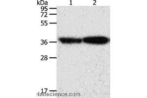 Western blot analysis of Human leiomyosarcoma and mouse testis tissue, using TPM2 Polyclonal Antibody at dilution of 1:1000 (TPM2 抗体)