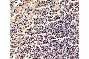 Immunohistochemistry (IHC) image for anti-Actin, beta (ACTB) antibody (ABIN3029837)