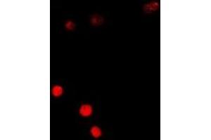 Immunofluorescent analysis of SSX5 staining in A549 cells. (SSX5 抗体)