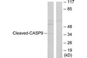 Western blot analysis of extracts from HeLa cells, treated with Etoposide 25uM 60', using Caspase 9 (Cleaved-Asp330) Antibody. (Caspase 9 抗体  (Cleaved-Asp330))