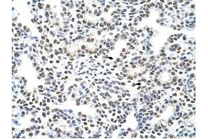 HNRPA3 antibody was used for immunohistochemistry at a concentration of 4-8 ug/ml to stain Alveolar cells (arrows) in Human Lung. (HNRNPA3 抗体  (N-Term))