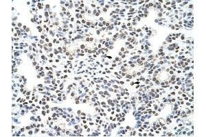 HNRPA3 antibody was used for immunohistochemistry at a concentration of 4-8 ug/ml to stain Alveolar cells (arrows) in Human Lung.