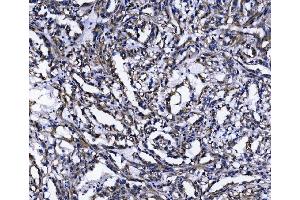IHC analysis of TOMM70 using anti-TOMM70 antibody (ABIN7599855). (TOM70 抗体  (AA 122-608))