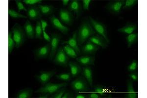 Immunofluorescence of monoclonal antibody to S100A13 on HeLa cell. (S100A13 抗体  (AA 1-98))