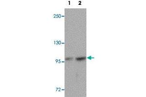 Western blot analysis of FREM2 in A-20 cell lysate with FREM2 polyclonal antibody  at (1) 0. (FREM2 抗体  (Internal Region))