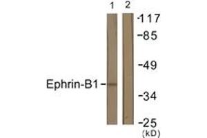 Western blot analysis of extracts from COS7 cells, using EFNB1 (Ab-317) Antibody. (Ephrin B1 抗体  (AA 283-332))