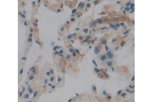 IHC-P analysis of Human Tissue, with DAB staining. (PLA2G4A 抗体  (AA 1-178))