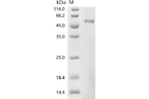 Keratin 35 (KRT35) (AA 1-455), (full length) protein (His tag)