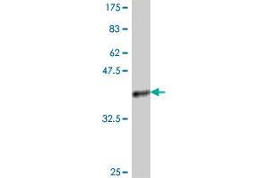 Western Blot detection against Immunogen (37. (PSMB3 抗体  (AA 106-205))