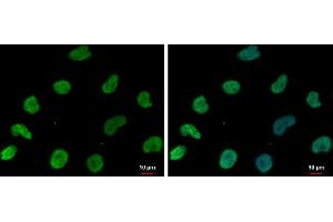 ICC/IF Image DNAJB6 antibody [N3C3] detects DNAJB6 protein at nucleus by immunofluorescent analysis. (DNAJB6 抗体  (Center))
