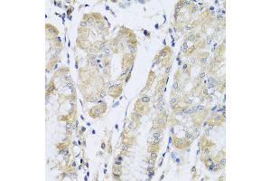 Immunohistochemistry of paraffin-embedded human stomach using FANCA antibody at dilution of 1:100 (x40 lens). (FANCA 抗体)