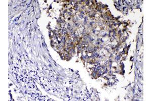 IHC analysis of Relaxin 1 using anti-Relaxin 1 antibody . (Relaxin 1 抗体)