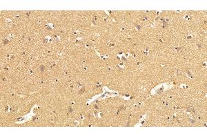 Detection of TXNIP in Human Cerebrum Tissue using Polyclonal Antibody to Thioredoxin-interacting Protein (TXNIP) (TXNIP 抗体  (AA 32-367))